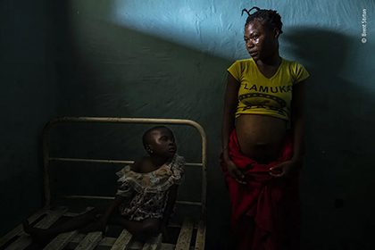 Photojournalist Story Award - Brent Stirton - The human factor